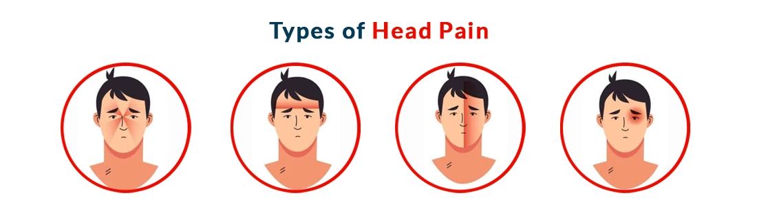 Types of Head Pain